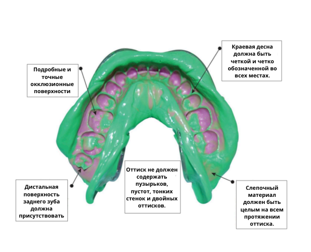 Detailed and precise occlusal surfaces (3) Otisak
